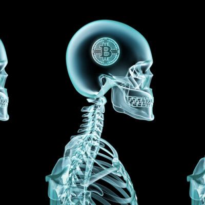 x-ray-skeleton-in-blue-with-bitcoin-inside-skull-400x400